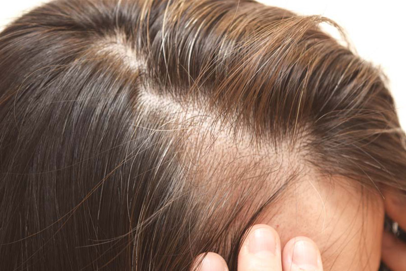 Mistakes That Prevent Hair Growth